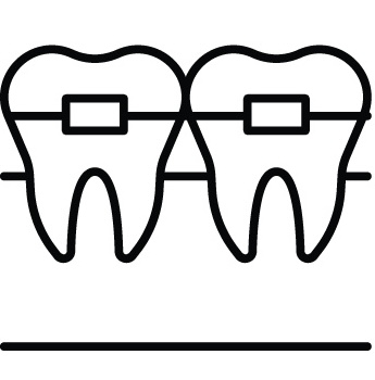 Orthodontic treatment - braces and teeth alignment procedures